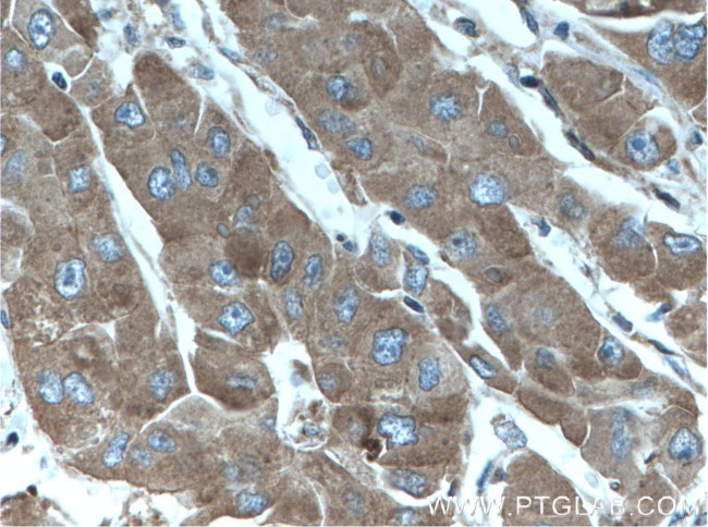 ANGPTL8 Antibody in Immunohistochemistry (Paraffin) (IHC (P))