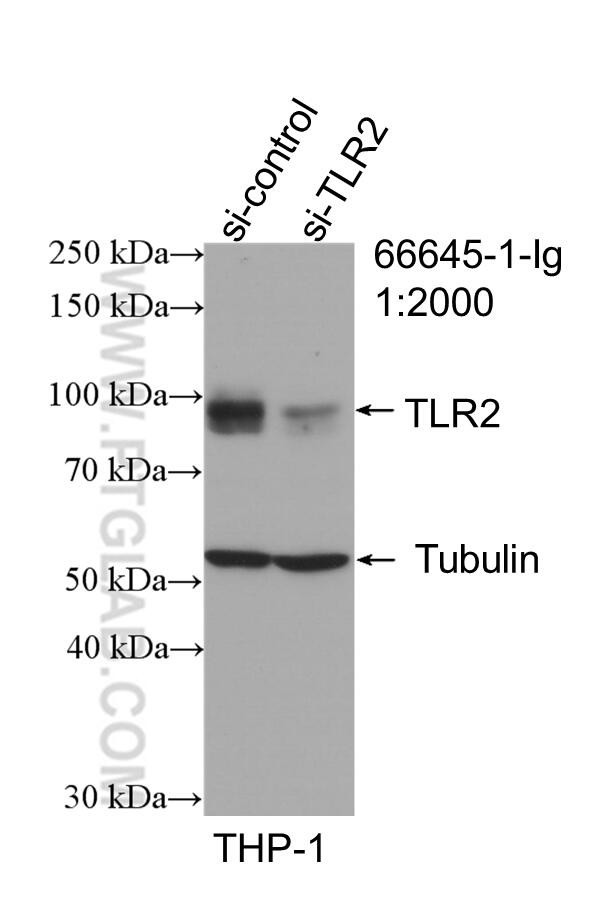 TLR2 Antibody in Western Blot (WB)