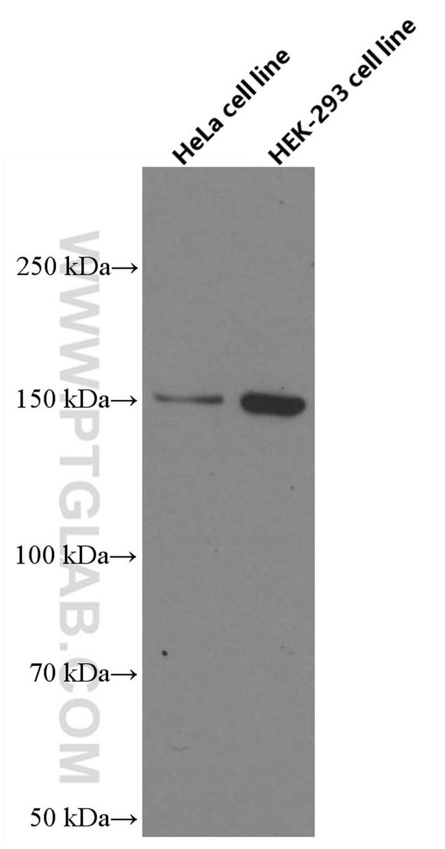 RAB3GAP2 Antibody in Western Blot (WB)