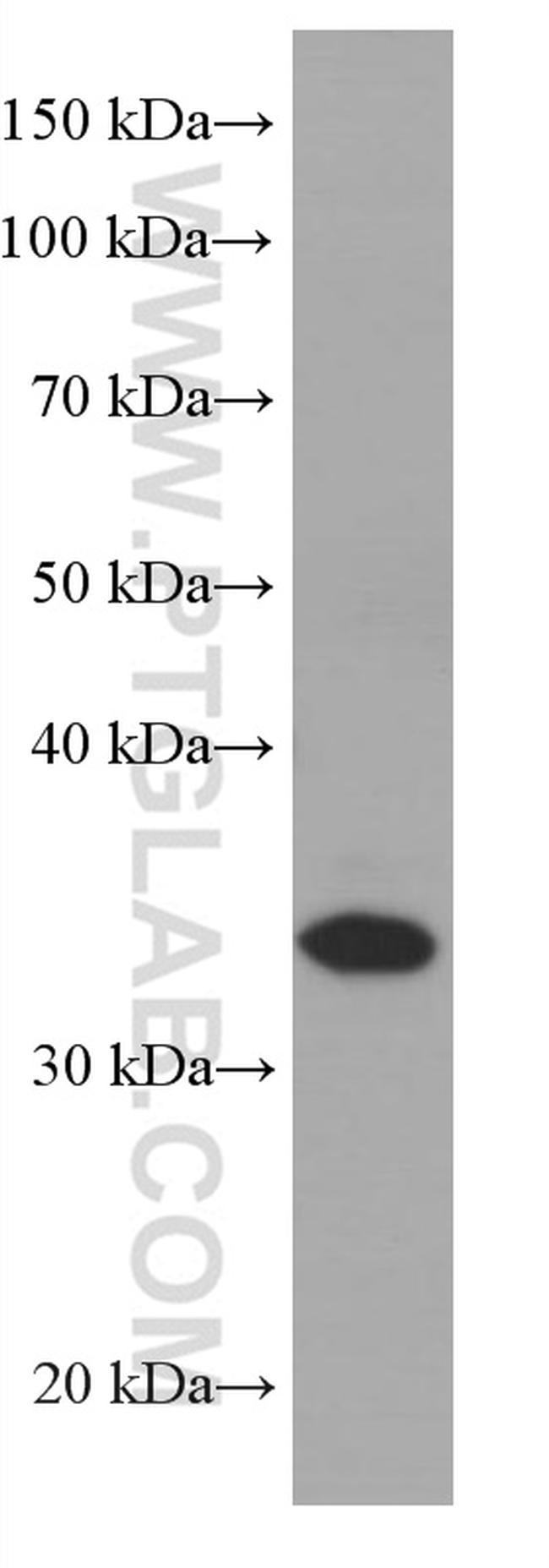 CEBPB Antibody in Western Blot (WB)