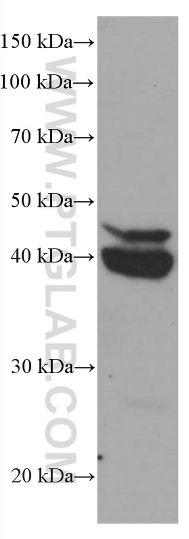 CEBPB Antibody in Western Blot (WB)