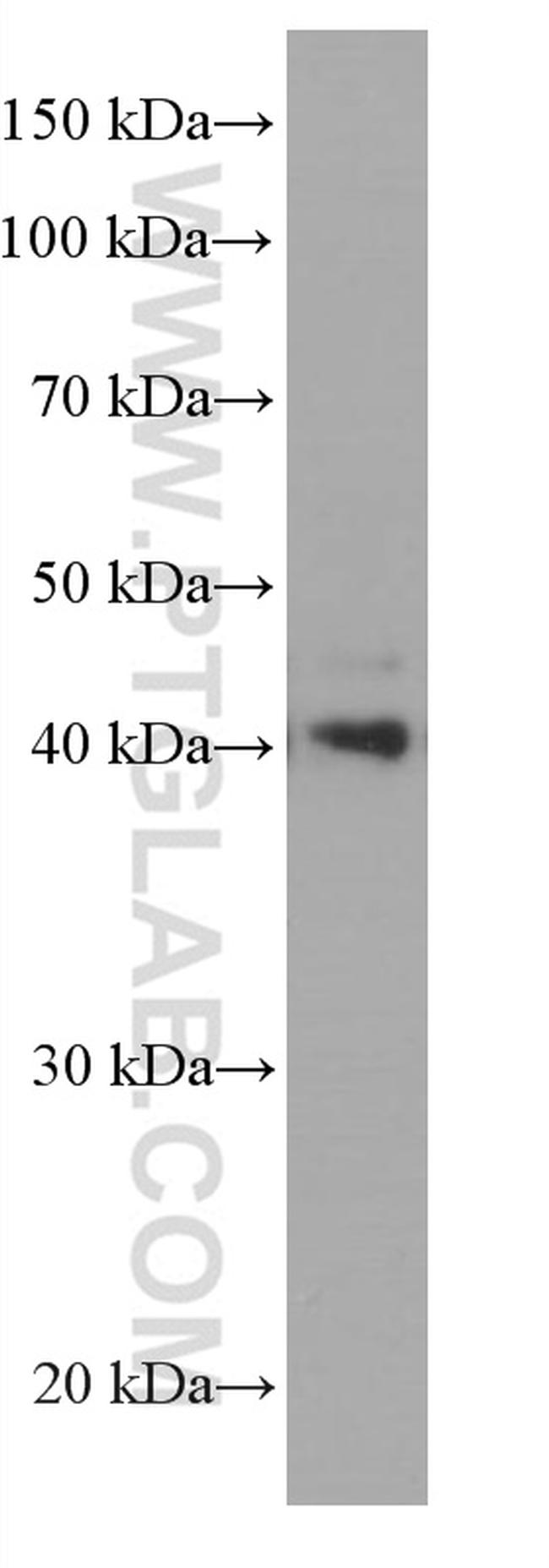 CEBPB Antibody in Western Blot (WB)