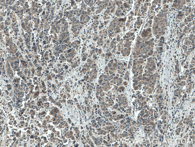 GRASP65/GORASP1 Antibody in Immunohistochemistry (Paraffin) (IHC (P))