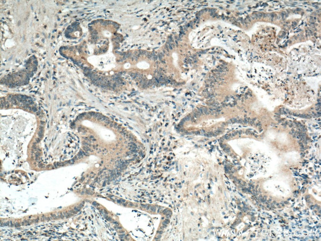 GRASP65/GORASP1 Antibody in Immunohistochemistry (Paraffin) (IHC (P))