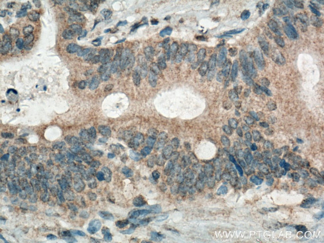 GRASP65/GORASP1 Antibody in Immunohistochemistry (Paraffin) (IHC (P))