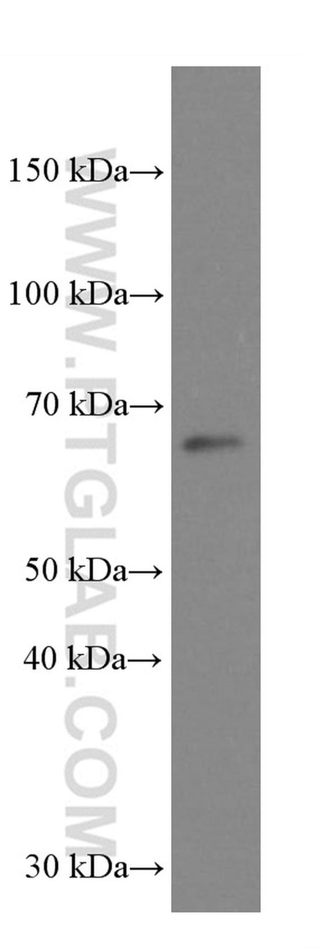 GRASP65/GORASP1 Antibody in Western Blot (WB)