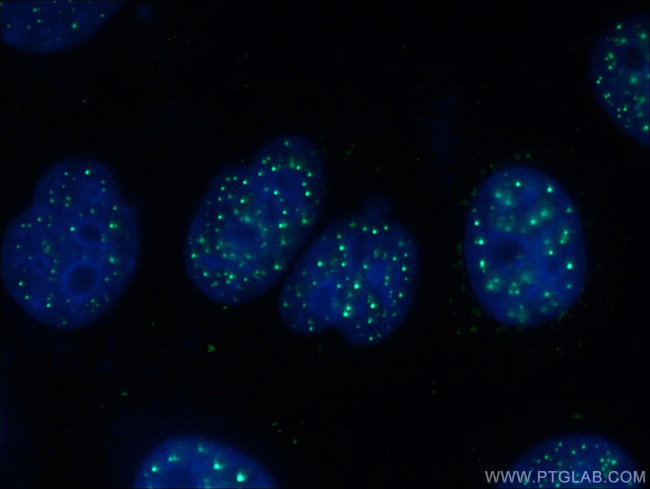 XRCC2 Antibody in Immunocytochemistry (ICC/IF)