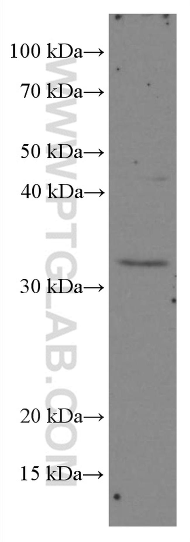 XRCC2 Antibody in Western Blot (WB)