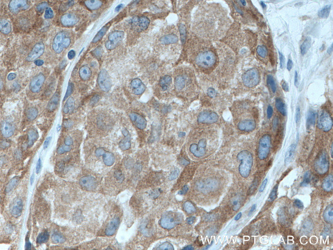 IRAK1 Antibody in Immunohistochemistry (Paraffin) (IHC (P))