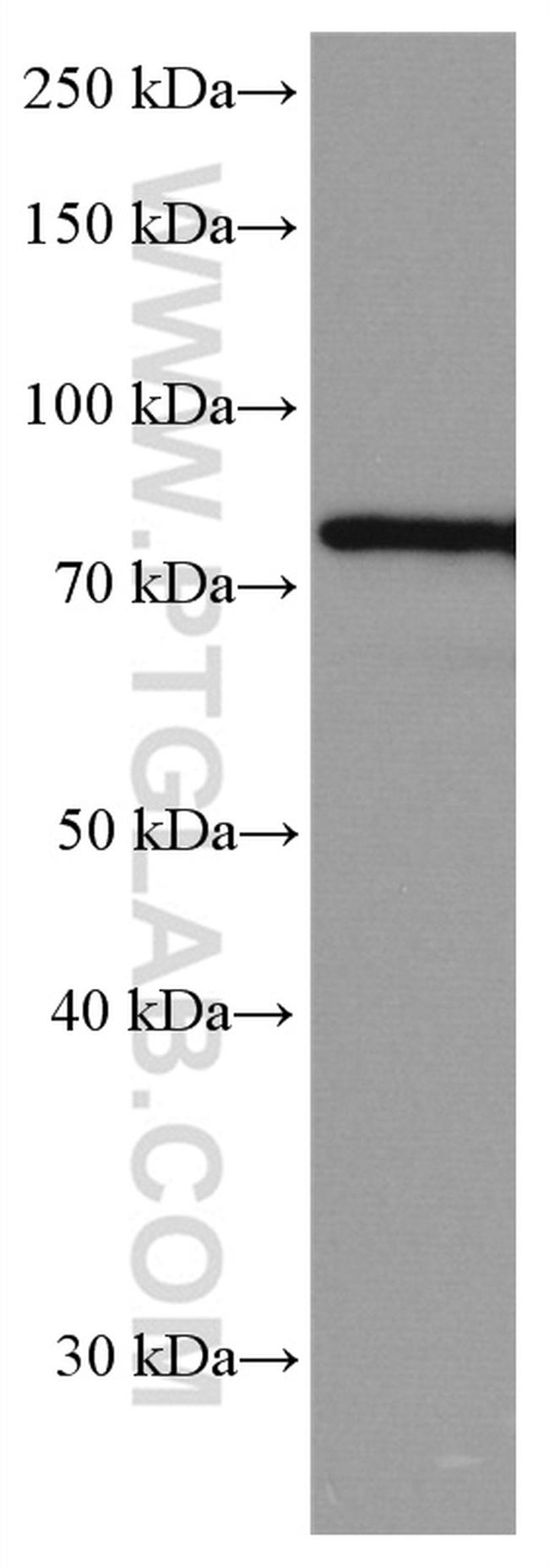 IRAK1 Antibody in Western Blot (WB)