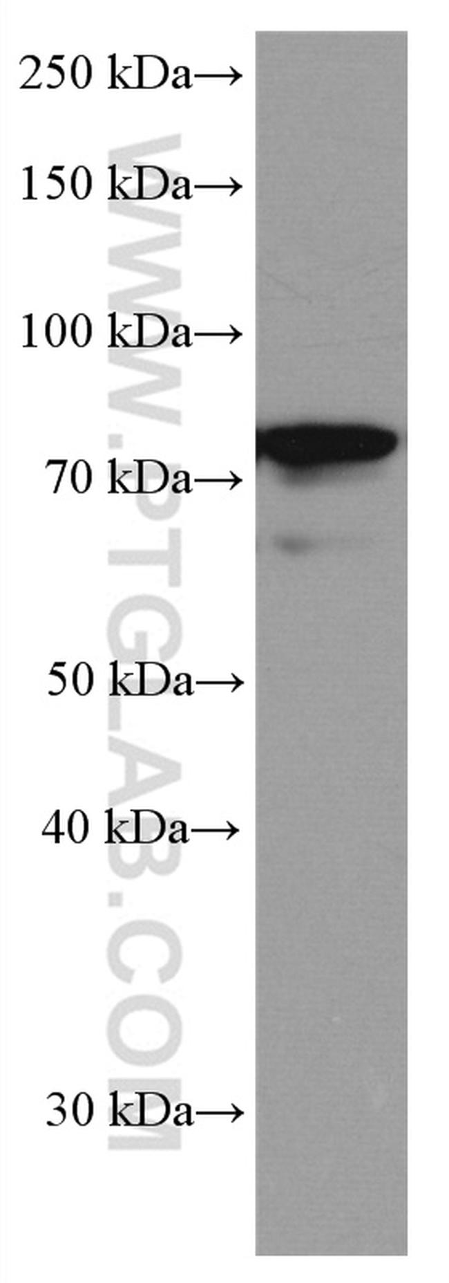 IRAK1 Antibody in Western Blot (WB)