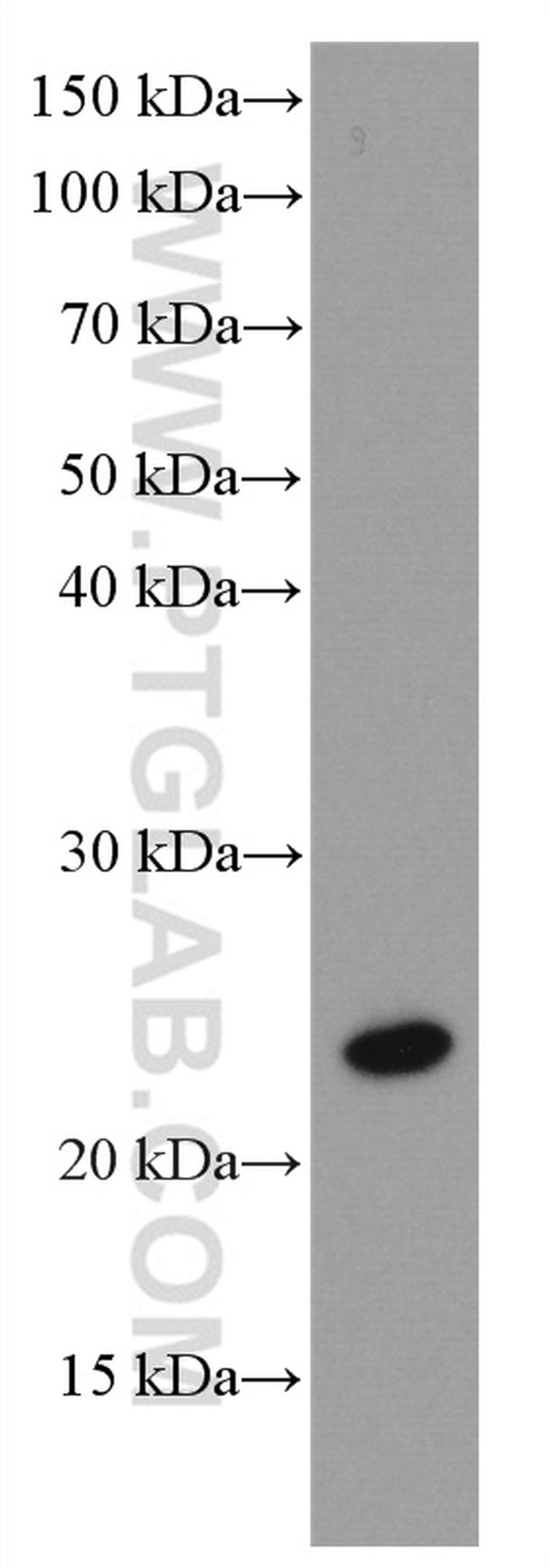 RAB43 Antibody in Western Blot (WB)