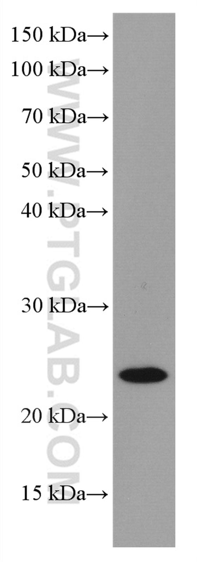 RAB43 Antibody in Western Blot (WB)