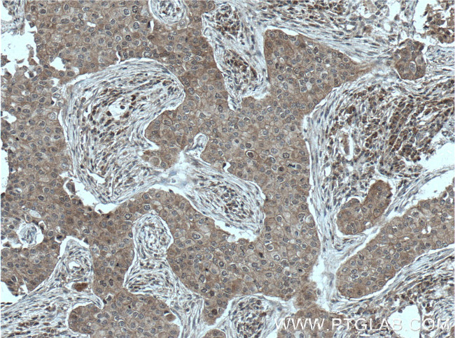 BAG6 Antibody in Immunohistochemistry (Paraffin) (IHC (P))