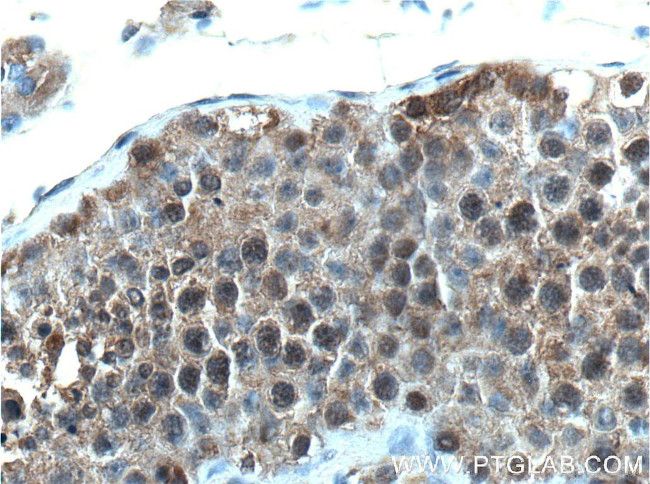 BAG6 Antibody in Immunohistochemistry (Paraffin) (IHC (P))