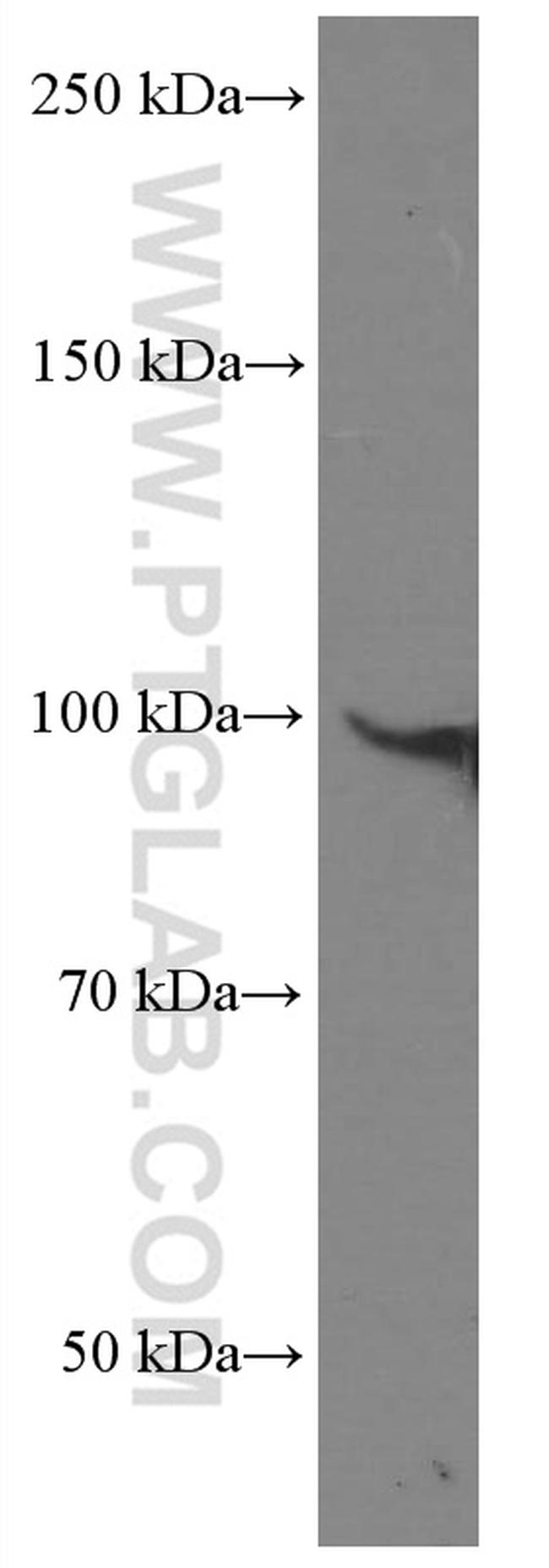 DDX54 Antibody in Western Blot (WB)