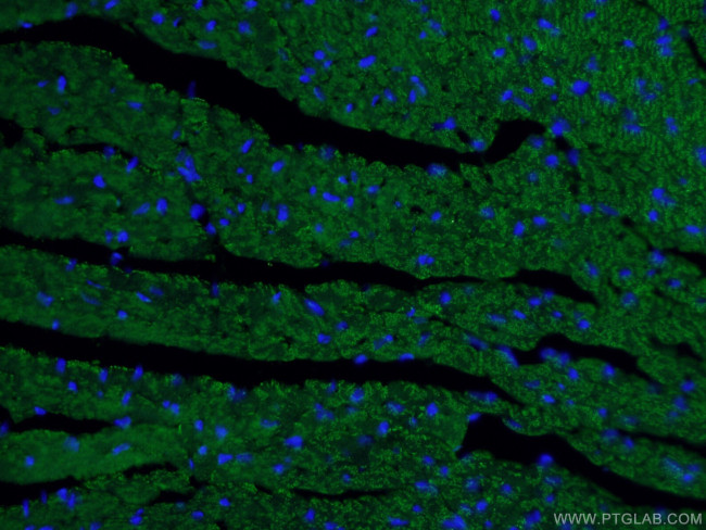 Beclin 1 Antibody in Immunohistochemistry (PFA fixed) (IHC (PFA))