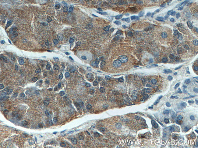 Beclin 1 Antibody in Immunohistochemistry (Paraffin) (IHC (P))