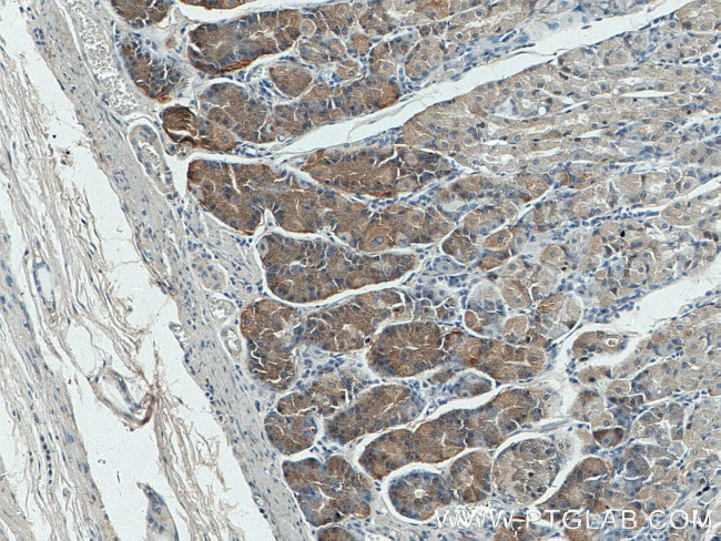 Beclin 1 Antibody in Immunohistochemistry (Paraffin) (IHC (P))