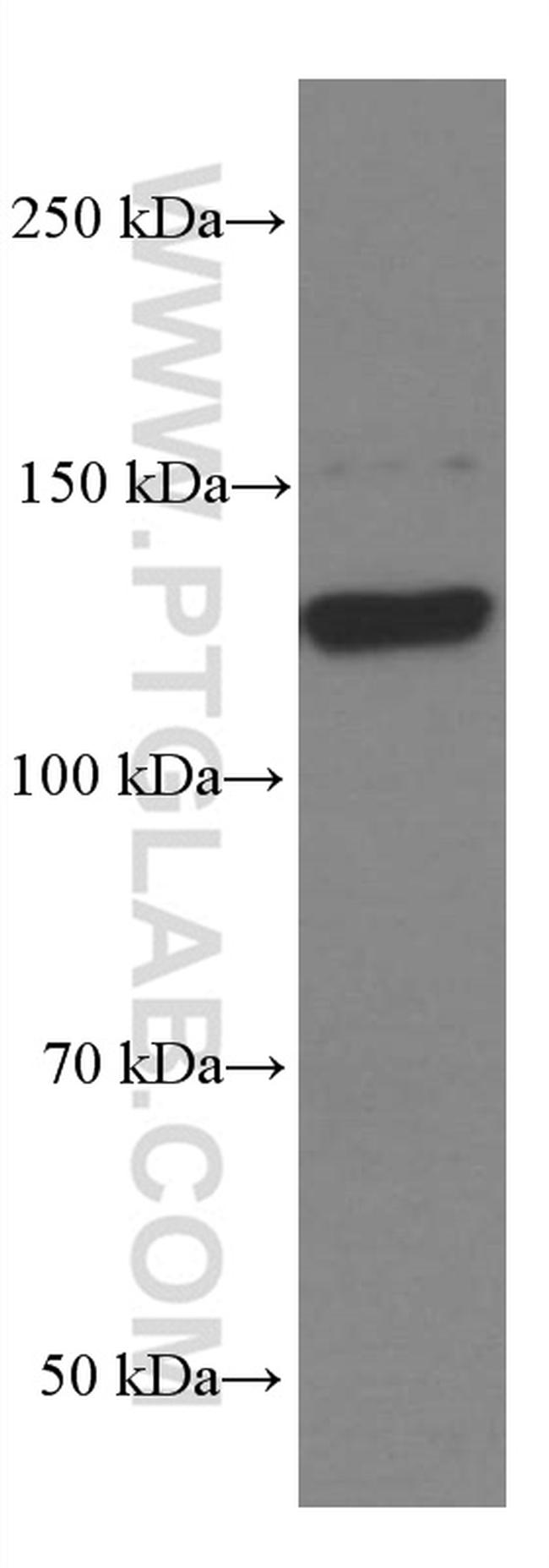EPHA7 Antibody in Western Blot (WB)