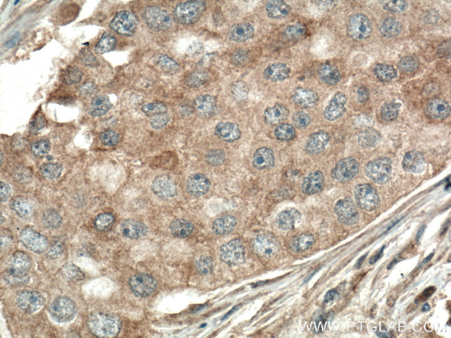 PLCB3 Antibody in Immunohistochemistry (Paraffin) (IHC (P))