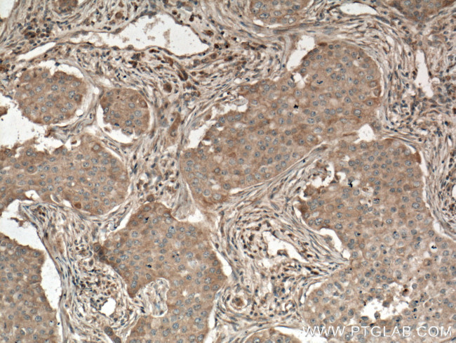 PLCB3 Antibody in Immunohistochemistry (Paraffin) (IHC (P))