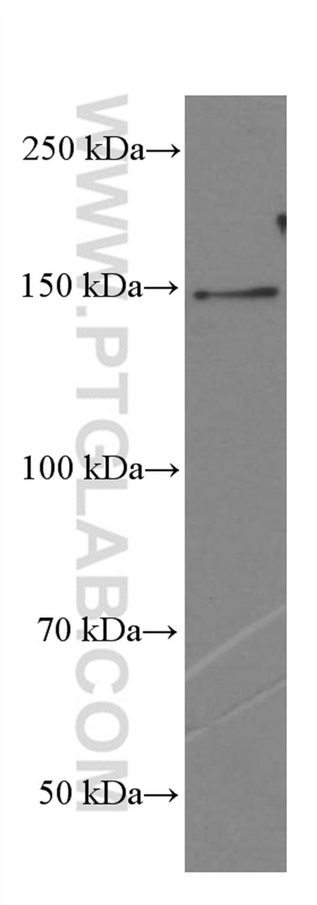 PLCB3 Antibody in Western Blot (WB)