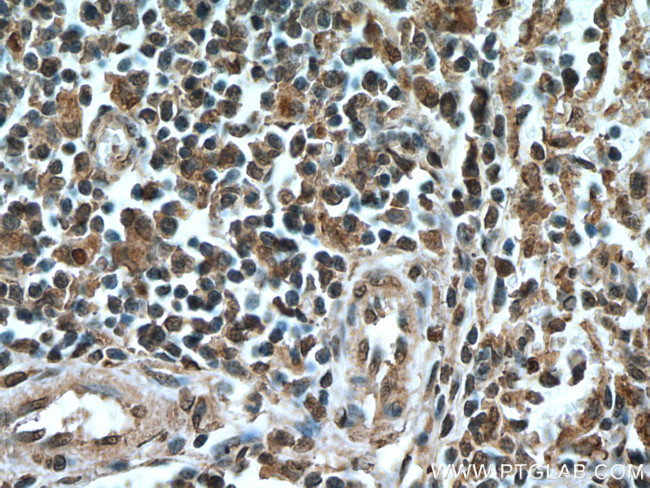 IRF3 Antibody in Immunohistochemistry (Paraffin) (IHC (P))