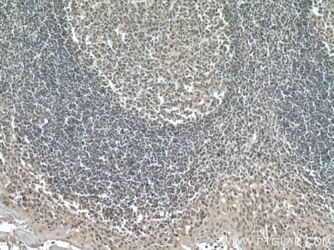 IRF3 Antibody in Immunohistochemistry (Paraffin) (IHC (P))