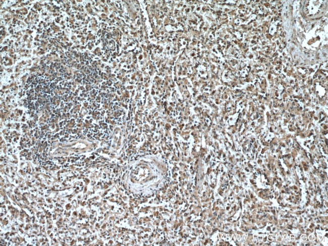 IRF3 Antibody in Immunohistochemistry (Paraffin) (IHC (P))