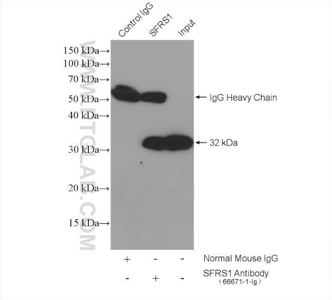 ASF/SF2 Antibody in Immunoprecipitation (IP)