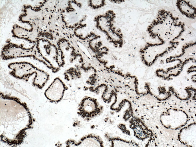 ASF/SF2 Antibody in Immunohistochemistry (Paraffin) (IHC (P))