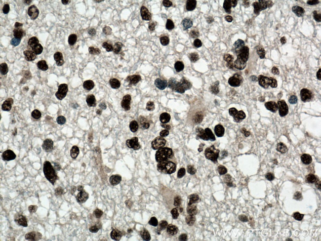 ASF/SF2 Antibody in Immunohistochemistry (Paraffin) (IHC (P))