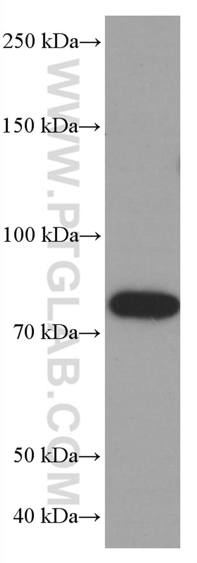 PLZF Antibody in Western Blot (WB)