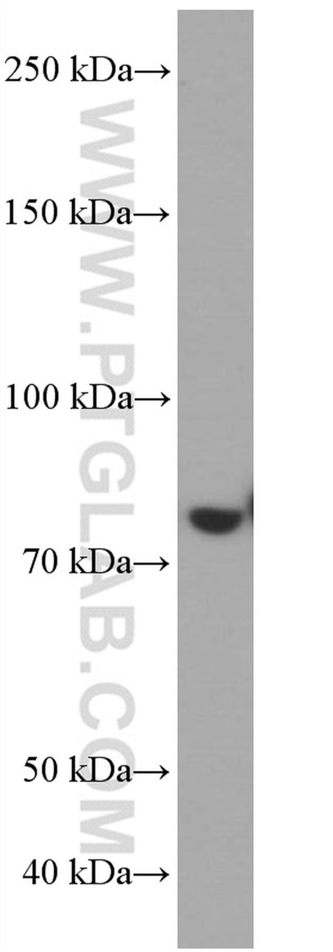 PLZF Antibody in Western Blot (WB)