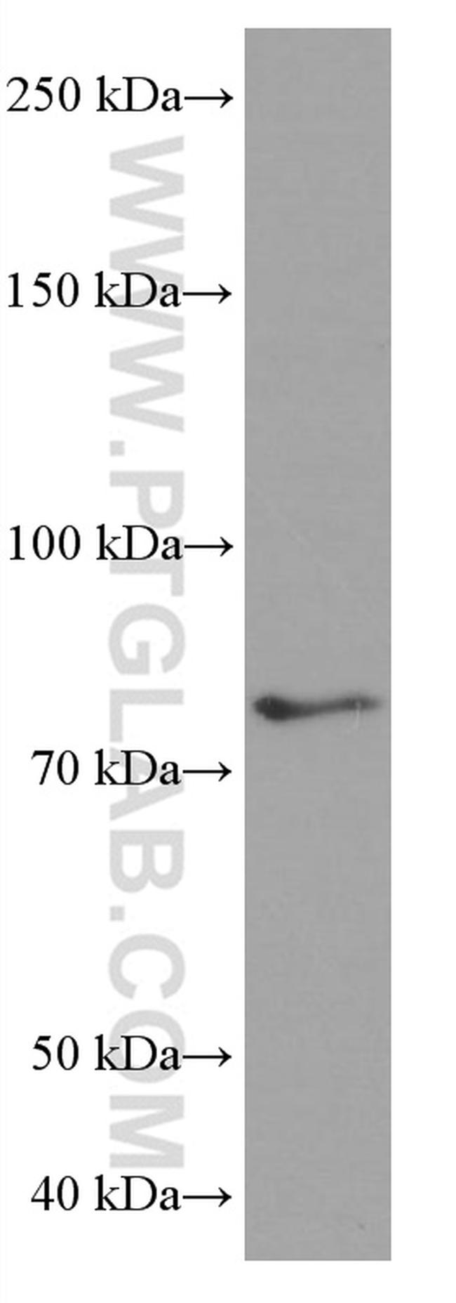 PLZF Antibody in Western Blot (WB)