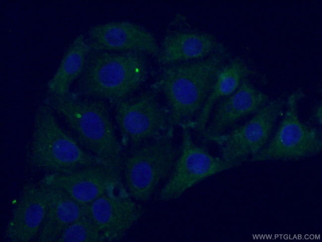 PARK2/Parkin Antibody in Immunocytochemistry (ICC/IF)