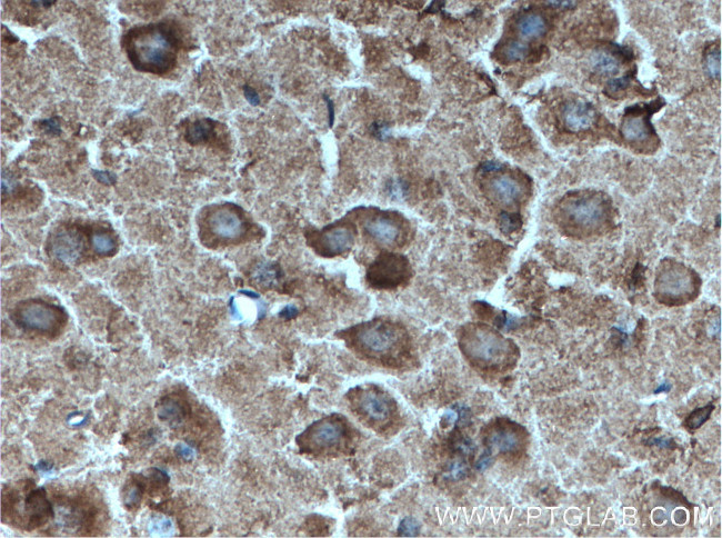 PARK2/Parkin Antibody in Immunohistochemistry (Paraffin) (IHC (P))