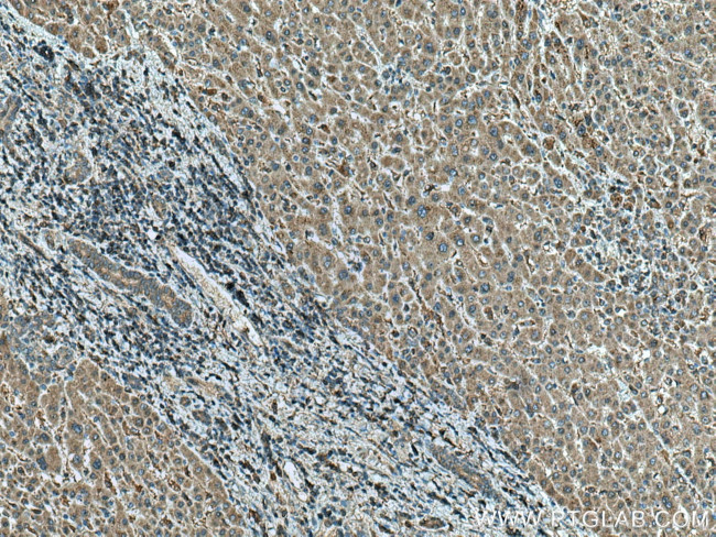 MLKL Antibody in Immunohistochemistry (Paraffin) (IHC (P))