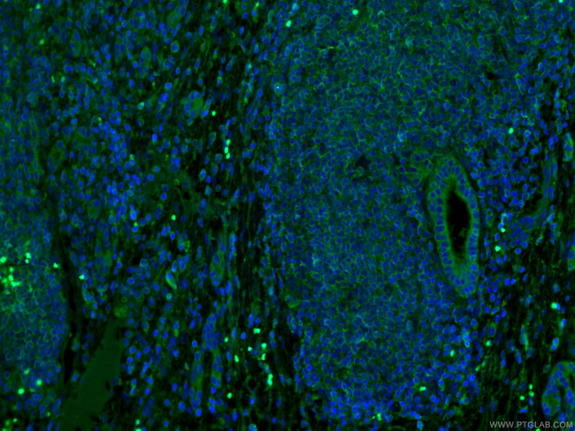 MLKL Antibody in Immunohistochemistry (PFA fixed) (IHC (PFA))