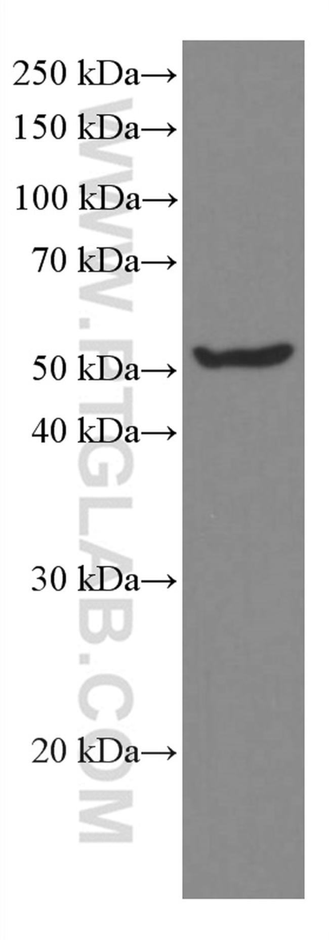 MLKL Antibody in Western Blot (WB)