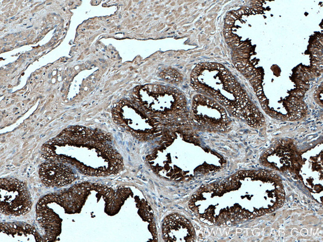 PSMA/GCPII Antibody in Immunohistochemistry (Paraffin) (IHC (P))