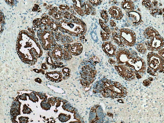 PSMA/GCPII Antibody in Immunohistochemistry (Paraffin) (IHC (P))