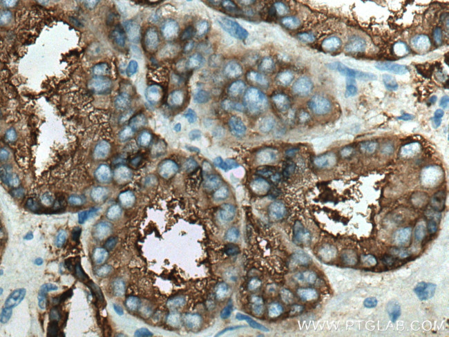 PSMA/GCPII Antibody in Immunohistochemistry (Paraffin) (IHC (P))