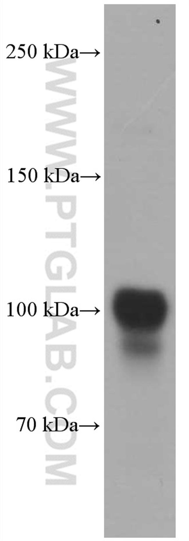 PSMA/GCPII Antibody in Western Blot (WB)