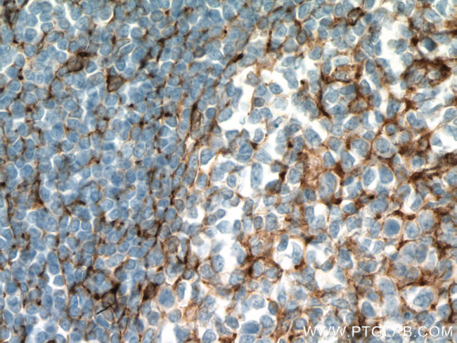 TMEM173/STING Antibody in Immunohistochemistry (Paraffin) (IHC (P))