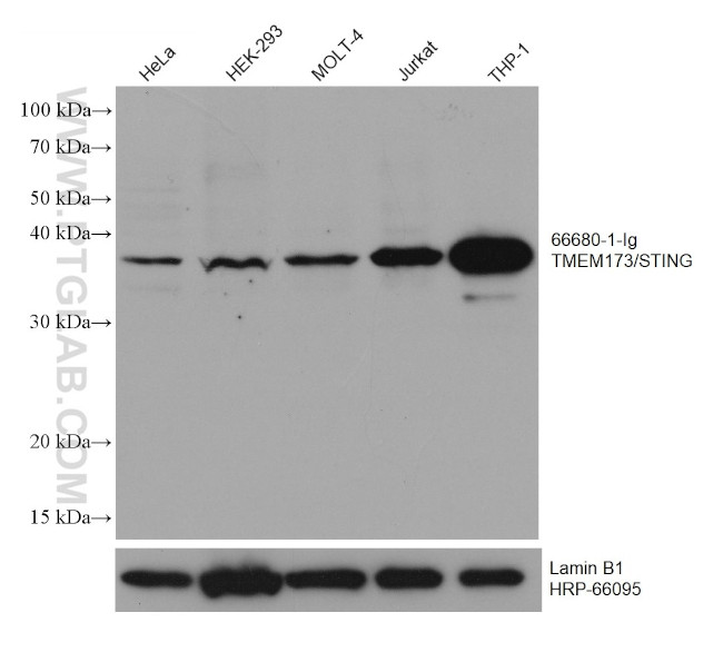 TMEM173/STING Antibody in Western Blot (WB)