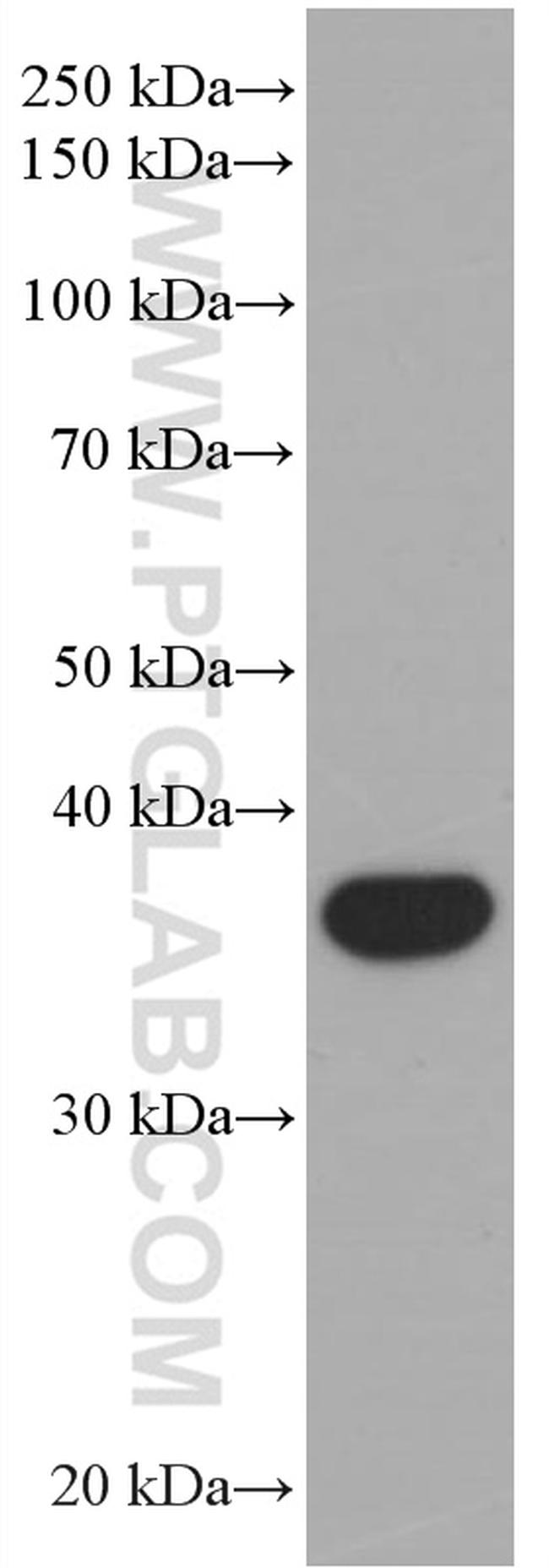 TMEM173/STING Antibody in Western Blot (WB)