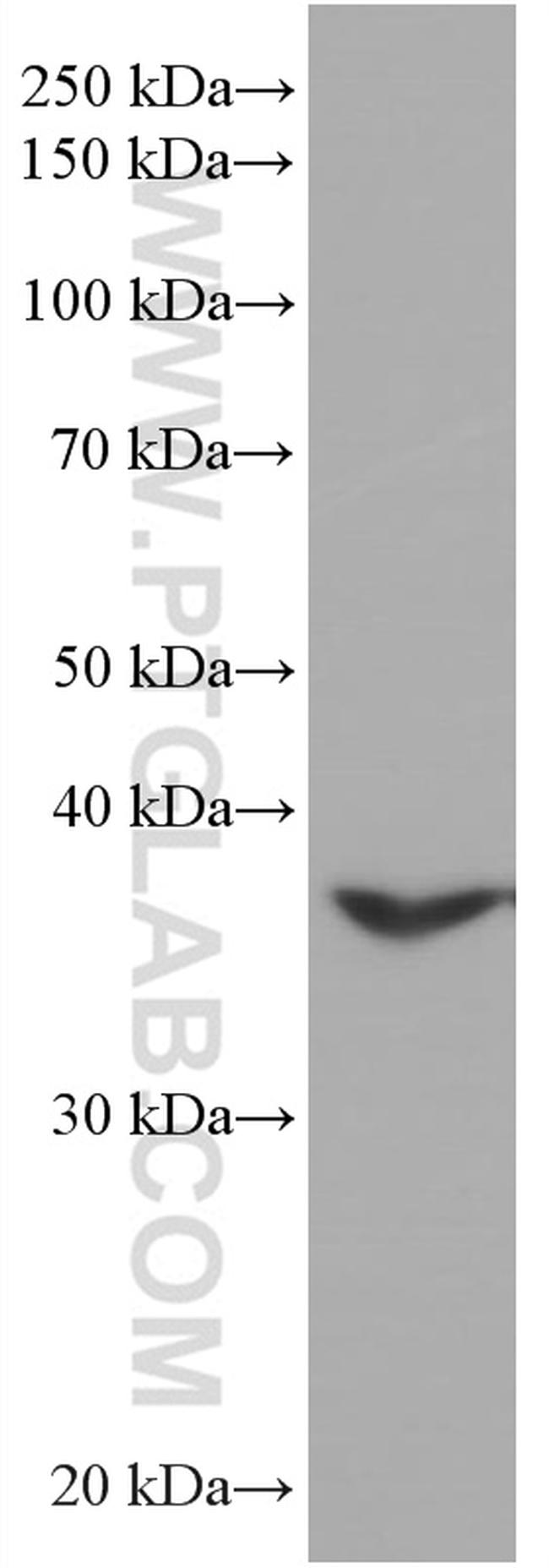 TMEM173/STING Antibody in Western Blot (WB)