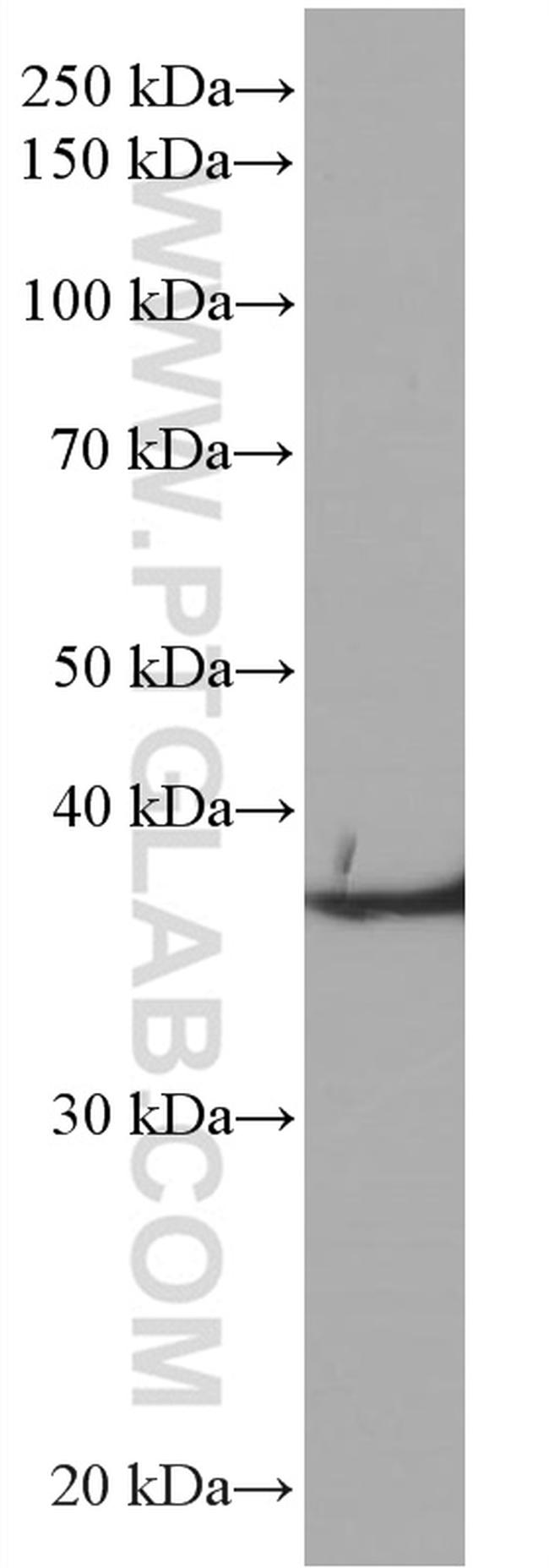 TMEM173/STING Antibody in Western Blot (WB)